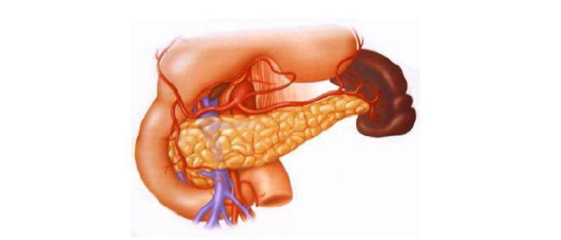 Изгиб поджелудочной железы. Поджелудочная железа человека. Загиб поджелудочной железы. Поджелудочная железа фото человека анатомия. Аберрантная поджелудочная железа.